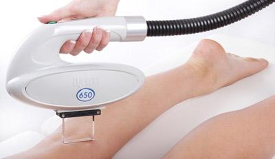 Hair removal laser treatment